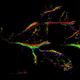 Illustration for article titled How Tiny Microbubbles Can Reveal the Hidden Structures Within Us